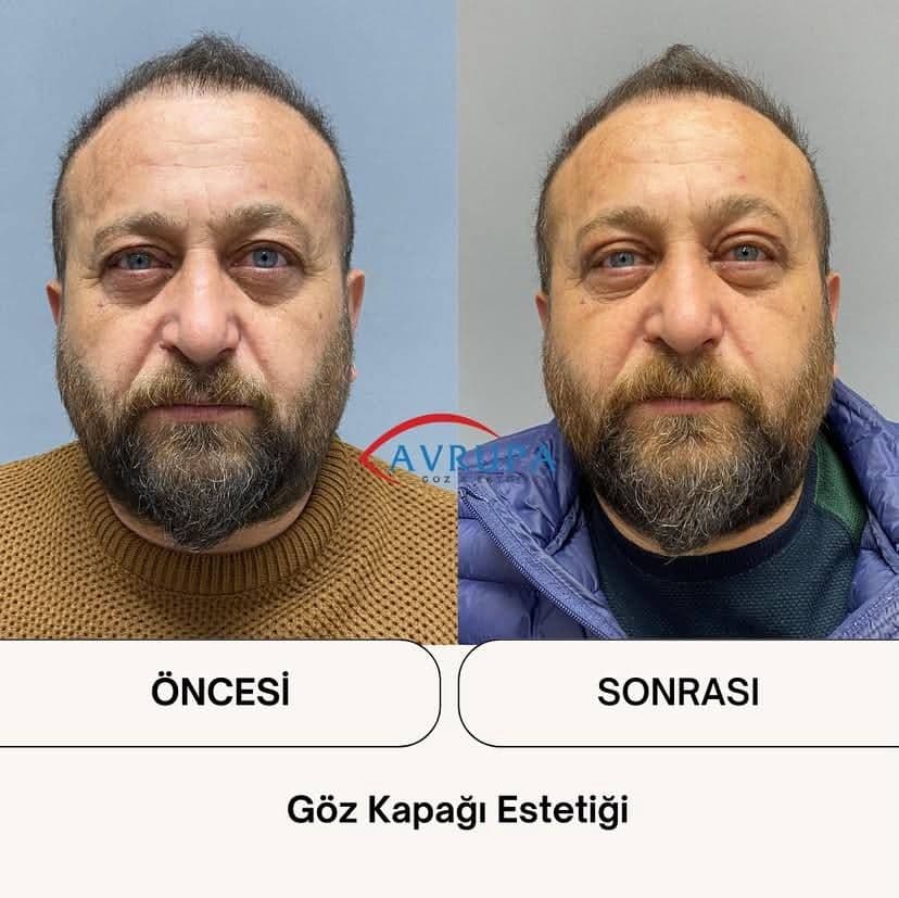 ikinci Üçlü foto