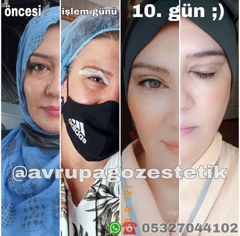 Bu bir fotodur