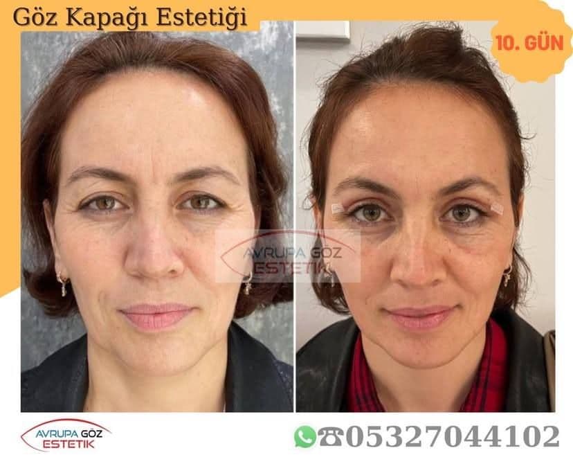 Bu bir fotodur