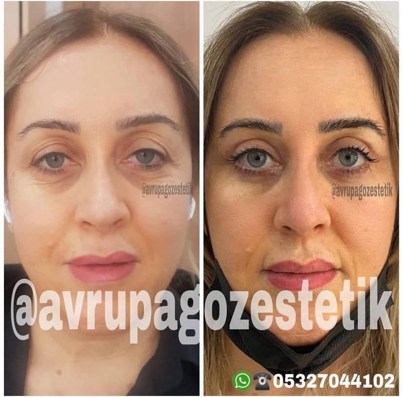 Bu bir fotodur