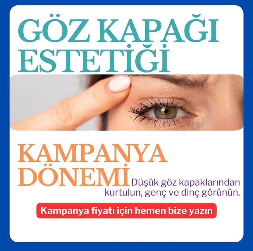 Badem göz estetiği